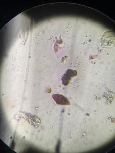 Alternaria mold spore under a microscope, verified by PollyMap