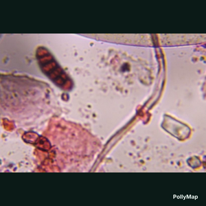 Bipolaris/Drechslera mold spore under a microscope, verified by PollyMap