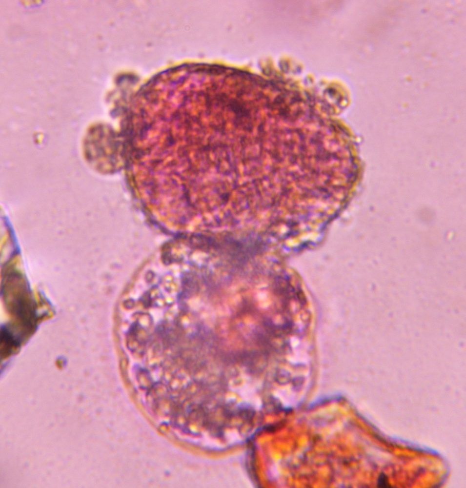Pine pollen under a microscope, verified by PollyMap