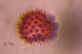 Asteraceae pollen under a microscope, verified by PollyMap