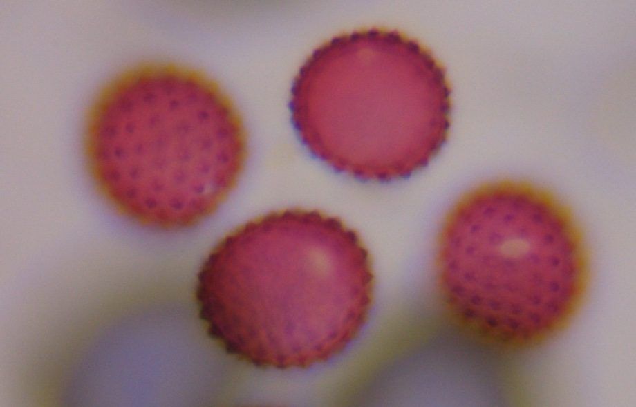 Asteraceae pollen under a microscope, verified by PollyMap