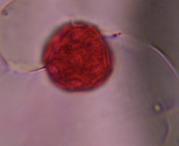 English plantain pollen under a microscope, verified by PollyMap