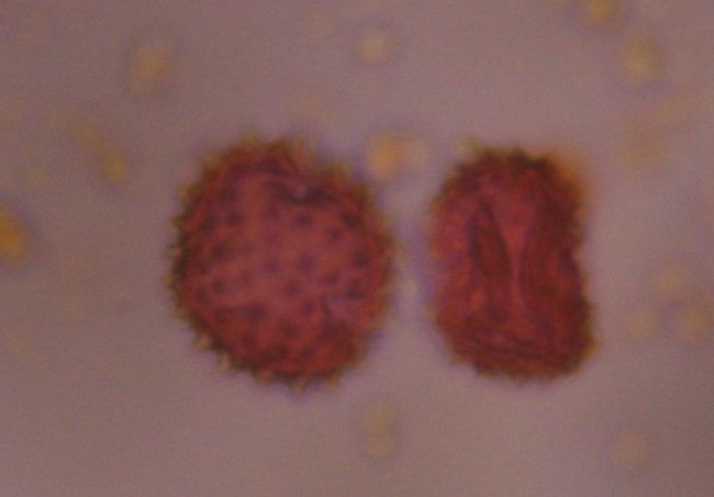 Asteraceae pollen under a microscope, verified by PollyMap
