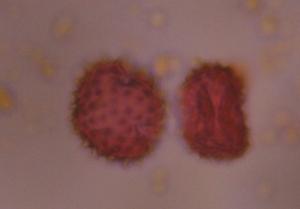 Asteraceae pollen under a microscope, verified by PollyMap