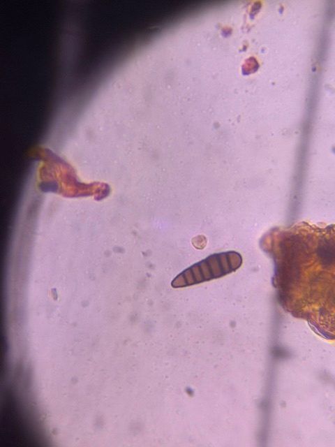 helminthosporium mold spore under a microscope, verified by PollyMap