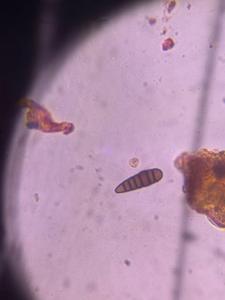 helminthosporium mold spore under a microscope, verified by PollyMap