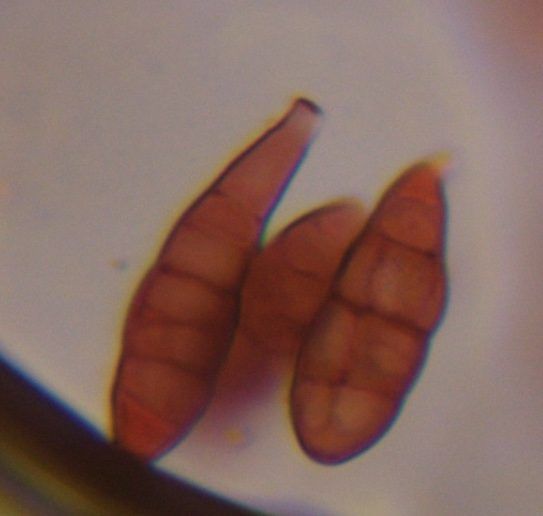 Alternaria mold spore under a microscope, verified by PollyMap