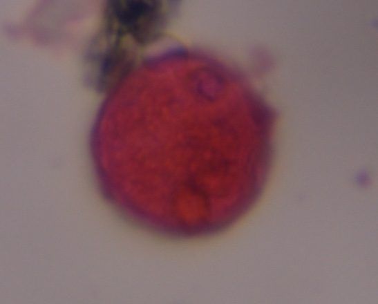 Poaceae pollen under a microscope, verified by PollyMap