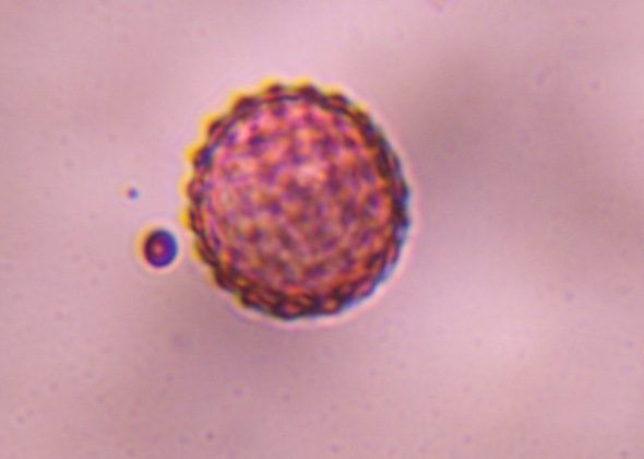 Another microscope image of Chenopod, verified by PollyMap
