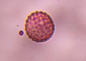 Chenopod pollen under a microscope, verified by PollyMap