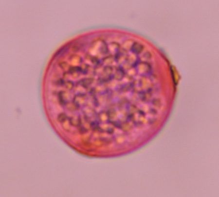 Another microscope image of Cannabis, verified by PollyMap