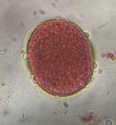 Grass pollen under a microscope, verified by PollyMap