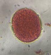 Grass pollen under a microscope, verified by PollyMap