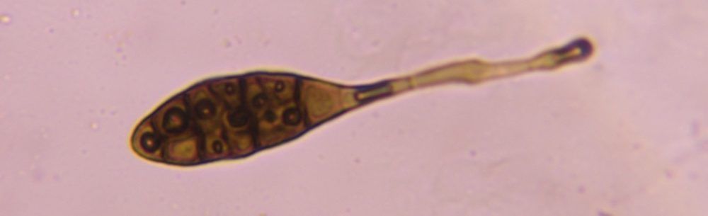 Another microscope image of Alternaria, verified by PollyMap