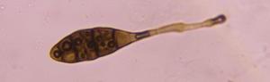 Alternaria mold spore under a microscope, verified by PollyMap