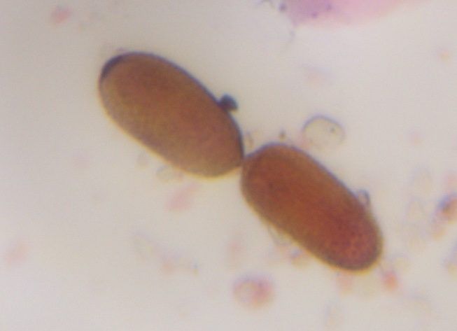 Fungal spore mold spore under a microscope, verified by PollyMap
