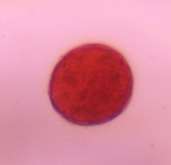 Another microscope image of Chenopod, verified by PollyMap