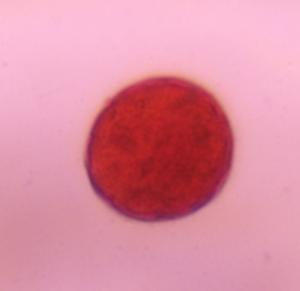 Chenopod pollen under a microscope, verified by PollyMap