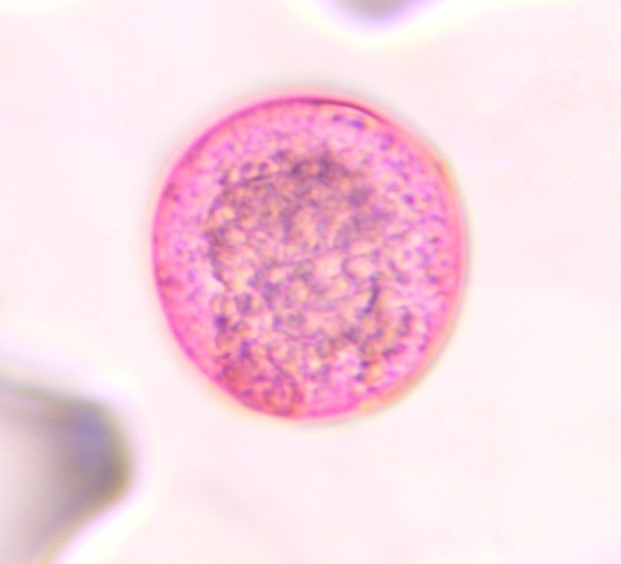 Poaceae pollen under a microscope, verified by PollyMap