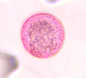 Poaceae pollen under a microscope, verified by PollyMap
