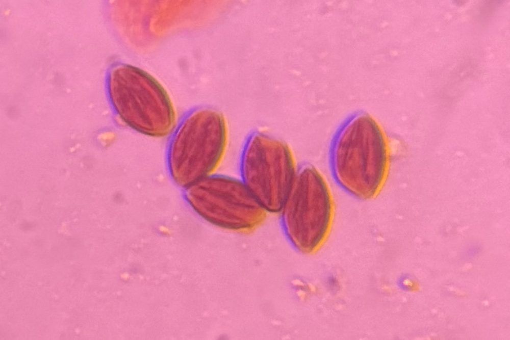 Fungal Spore mold spore under a microscope, verified by PollyMap