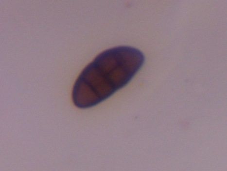 Pithomyces mold spore under a microscope, verified by PollyMap