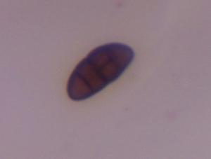 Pithomyces mold spore under a microscope, verified by PollyMap