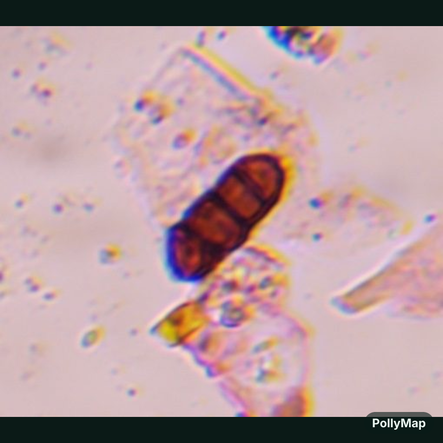Another microscope image of Bipolaris/Drechslera, verified by PollyMap
