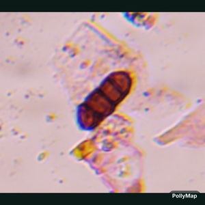 Bipolaris/Drechslera mold spore under a microscope, verified by PollyMap