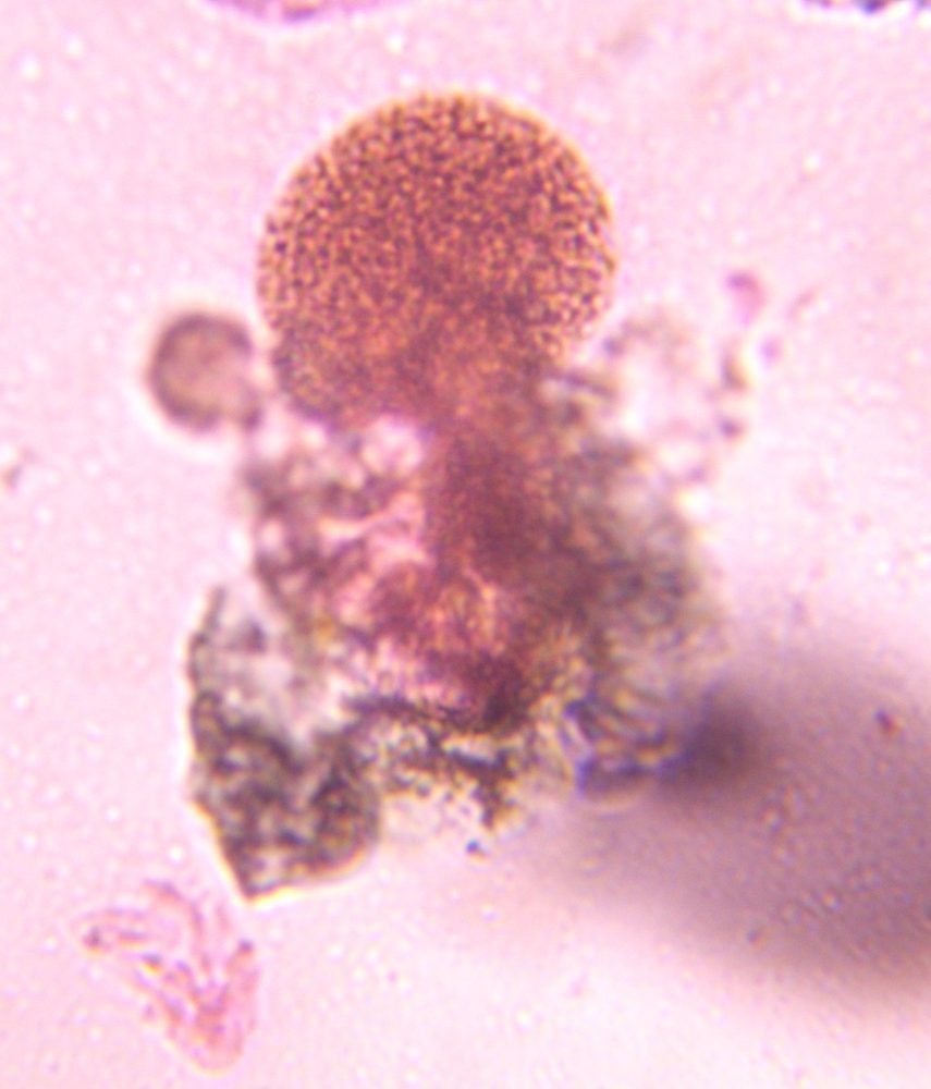 Pine pollen under a microscope, verified by PollyMap