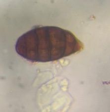 Another microscope image of Alternaria, verified by PollyMap