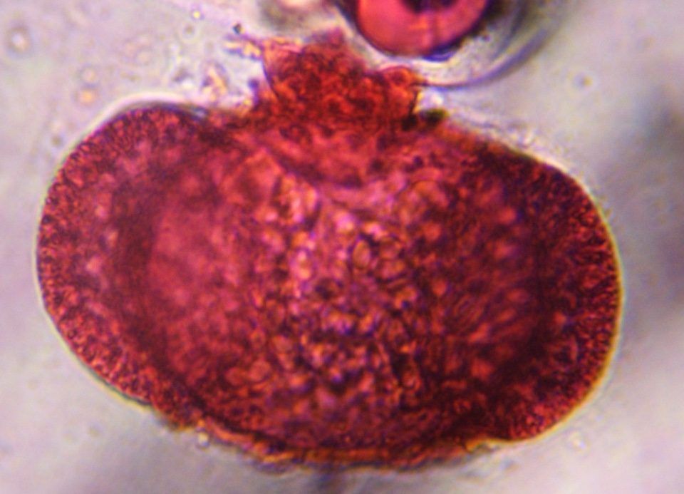 Another microscope image of Pine, verified by PollyMap