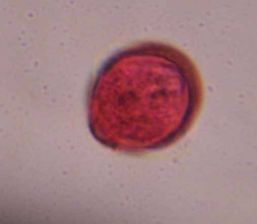 Artemisia pollen under a microscope, verified by PollyMap