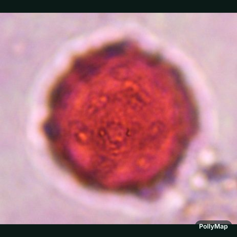 Another microscope image of Chenopod, verified by PollyMap