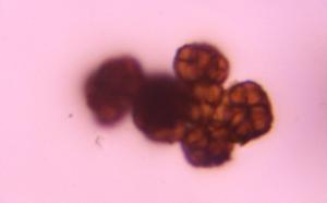 Epicoccum mold spore under a microscope, verified by PollyMap