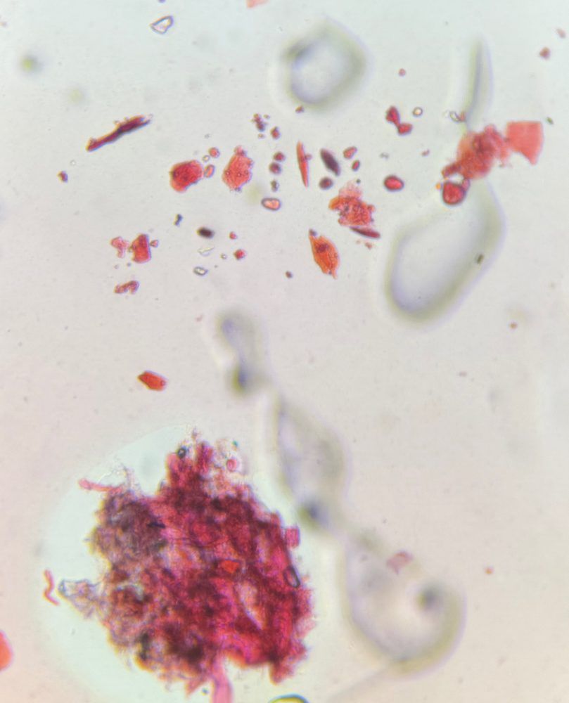 Microscope image of Skin cells, verified by PollyMap