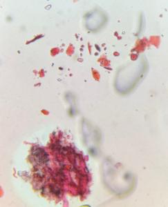 Skin cells particle under a microscope, verified by PollyMap