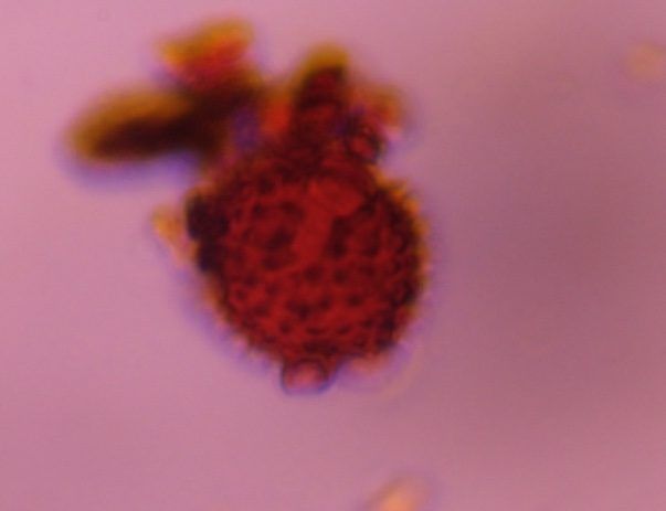 Another microscope image of Asteraceae, verified by PollyMap