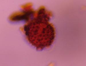 Asteraceae pollen under a microscope, verified by PollyMap