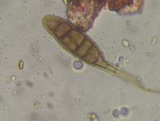 Another microscope image of Alternaria, verified by PollyMap