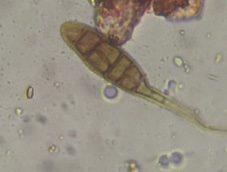 Alternaria mold spore under a microscope, verified by PollyMap