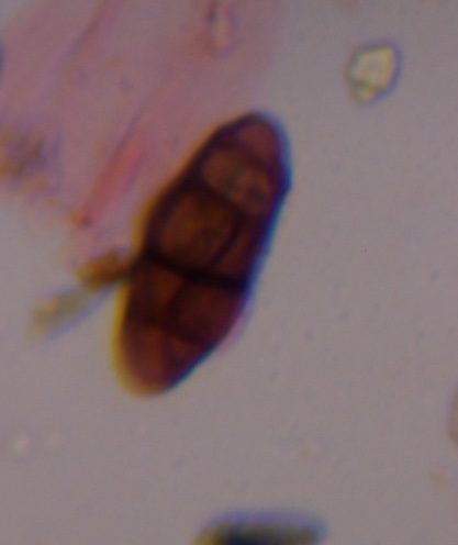 Alternaria mold spore under a microscope, verified by PollyMap