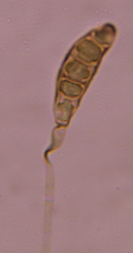Microscope image of Bipolaris/Drechslera, verified by PollyMap