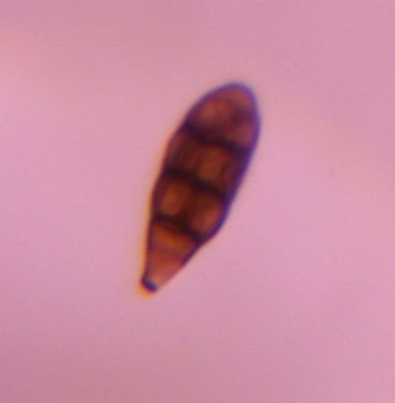 Alternaria mold spore under a microscope, verified by PollyMap