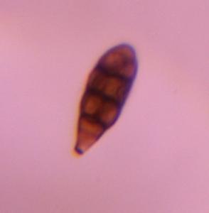 Alternaria mold spore under a microscope, verified by PollyMap