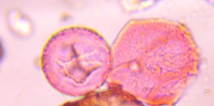 Juniper pollen under a microscope, verified by PollyMap