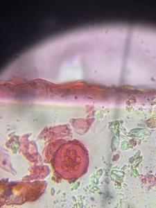 unknown pollen under a microscope, verified by PollyMap