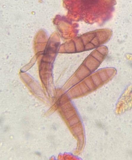 Another microscope image of Alternaria, verified by PollyMap