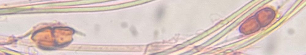 Unidentified Fungus mold spore under a microscope, verified by PollyMap
