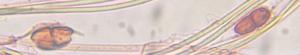 Unidentified Fungus mold spore under a microscope, verified by PollyMap